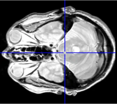 MRI Image